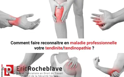 Douleurs articulaires (poignet, genou, doigt, épaule, coude) : comment faire reconnaître votre tendinite en maladie professionnelle.