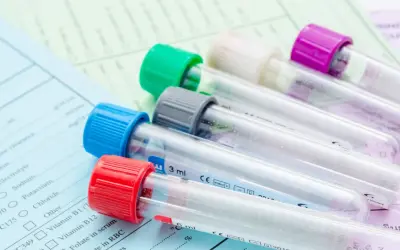 Kolorowe probówki na tle dokumentacji medycznej. Pokazują, ile ważne są badania krwi dla diagnostyki.