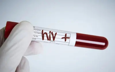 Rękawiczka medyczna trzyma probówkę z krwią oznaczoną "hiv +". Wynik testu na aids jest pozytywny.
