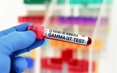 Ręka w niebieskiej rękawiczce trzyma probówkę z napisem "GAMMA GT TEST". Wynik badania wskazuje na ggtp norma.