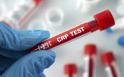 Rękawiczka trzyma probówkę z krwią do badania CRP. Cena tego testu jest kluczowa dla diagnostyki.