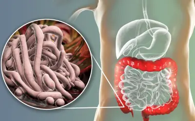 Gros plan sur des parasites intestinaux, avec une illustration du système digestif humain. Une vision pour un vermifuge humain naturel.
