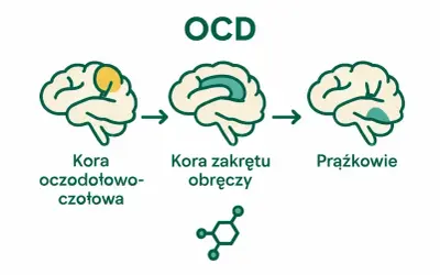Schemat wyjaśniający co to OCD: aktywność mózgu w korze oczodołowo-czołowej, korze zakrętu obręczy i ciałach prążkowanych.