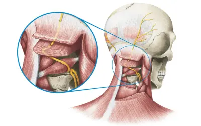 Anatomische Darstellung des Schädels und Nackens mit Fokus auf Nervenbahnen. Vergrößerter Bereich zeigt Nerven, die bei Occipitalis Neuralgie betroffen sein können.