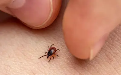 Garrapata marrón sobre piel humana, cerca de los dedos.