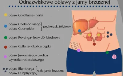Schemat jamy brzusznej z zaznaczonymi objawami, w tym objaw Jaworskiego w okolicy wyrostka robaczkowego.