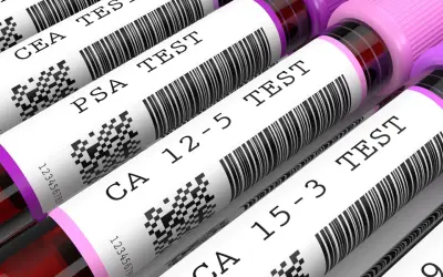 Rurki z próbkami krwi z etykietami: CEA TEST, PSA TEST, CA 12-5 TEST, CA 15-3 TEST.