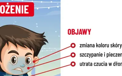 Chłopiec z bladą skórą i zmarzniętymi dłońmi, objawy odmrożenia: bladość, pieczenie, utrata czucia.