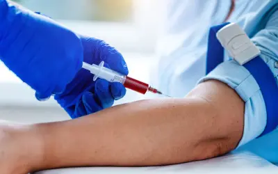 Pielęgniarka pobiera krew do strzykawki. Szybkie badanie krwi jest kluczowe dla diagnostyki.