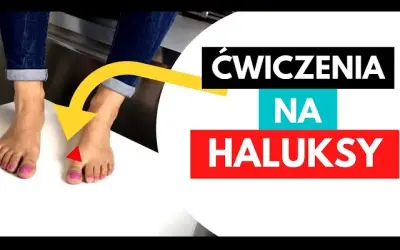 Domowe ćwiczenia na haluksy: Zwalcz ból i zatrzymaj deformację