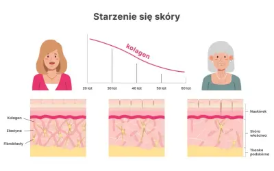 Niedobór kolagenu objawy: jak rozpoznać skutki braku kolagenu