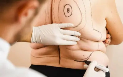Liposukcja laserowa: jak trwale usunąć tłuszcz i ujędrnić skórę?