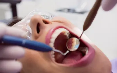 Zabieg piaskowania zębów w gabinecie stomatologicznym. Dentysta używa lusterka i piaskarki do oczyszczenia uzębienia.