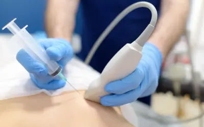 Lekarz w niebieskich rękawiczkach wykonuje biopsję mammotomiczną pod kontrolą USG.