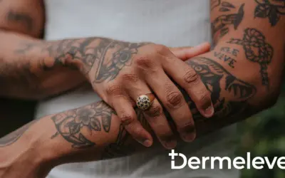 Brazo con tatuajes y un anillo con piedras oscuras. La piel luce sana, sin rastro de costra de tatuaje.