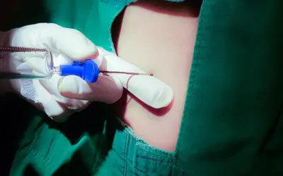 Precyzyjne znieczulenie przewodowe wewnątrzustne. Ręka w rękawiczce trzyma strzykawkę z igłą, gotową do podania środka znieczulającego.