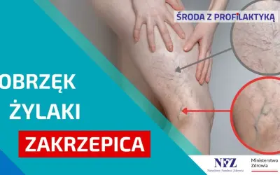 Jak zapobiec zakrzepicy? Skuteczna profilaktyka krok po kroku