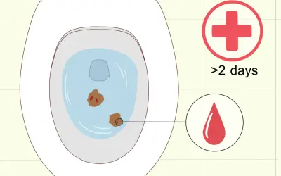 Biegunka w ciąży? W toalecie widać niepokojące objawy. Czerwony krzyż i kropla krwi sugerują, że czas szukać pomocy medycznej, zwłaszcza gdy trwa to dłużej niż 2 dni.