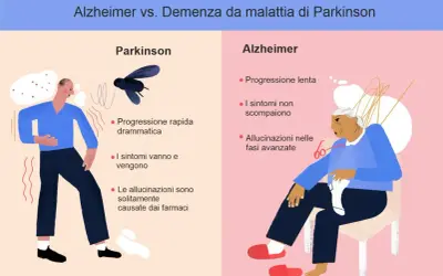 Confronto tra Parkinson e Alzheimer: progressione, sintomi e allucinazioni. Differenza tra parkinson e alzheimer illustrata con icone.