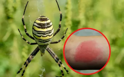 Tygrzyk paskowany na sieci, obok zaczerwieniona skóra po ugryzieniu.