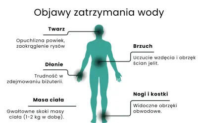 Objawy zatrzymania wody w organizmie: opuchlizna twarzy, dłoni, brzucha, nóg i kostek, a także gwałtowne skoki masy ciała.