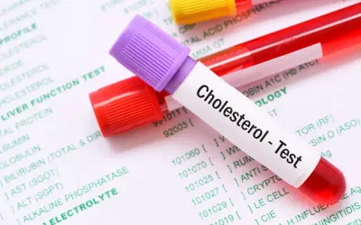 Probówki z krwią na tle dokumentu z badaniami. Jedna probówka ma etykietę "Cholesterol - Test". To pokazuje, lipidogram co to jest.