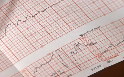 EKG: Przygotowanie krok po kroku. Pewny wynik bez obaw!
