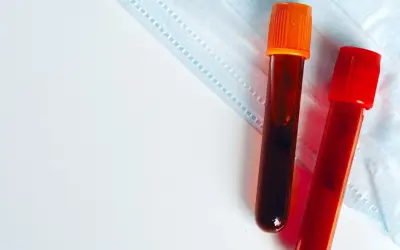 Dwie probówki z krwią na tle maseczki ochronnej. Wyniki badań, w tym egfr norma, czekają na analizę.