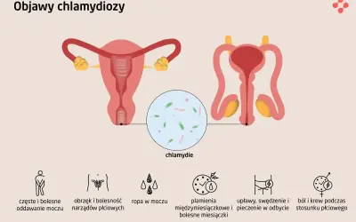 Objawy chlamydiozy: ból przy oddawaniu moczu, obrzęk narządów płciowych, ropna wydzielina, plamienia, pieczenie w odbycie, ból i krew podczas stosunku.
