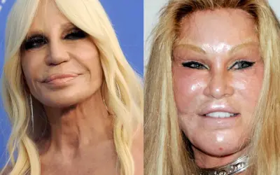 Donatella Versace i Jocelyn Wildenstein – które gwiazdy przeszły nieudane operacje plastyczne twarzy w Polsce?