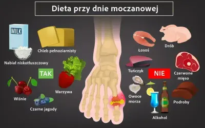 Dieta przy dnie moczanowej: TAK - nabiał, wiśnie, jagody, warzywa. NIE - czerwone mięso, podroby, alkohol. Milurit 100 może pomóc.
