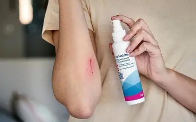 Persona aplica clorhexidina de Mercadona en un rasguño. Buenas clorhexidina Mercadona opiniones para curar heridas.