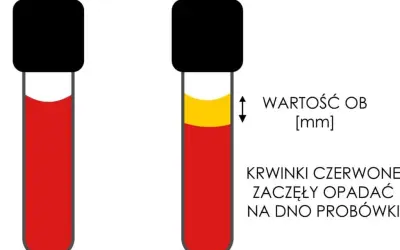 Skrzep w próbce krwi: Błąd czy choroba? Zrozum swój wynik
