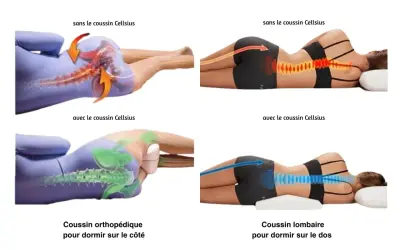 Comparaison de la posture du dos sans et avec coussin. Aide à soulager la douleur lombaire la nuit et le matin.