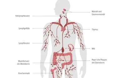 Das Lymphsystem mit Lymphknoten, Mandeln, Thymus, Milz und Darm. Mögliche Ursachen für Lymphom sind komplex und betreffen oft diese Organe.