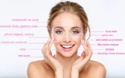 Uśmiechnięta kobieta z zaznaczonymi obszarami twarzy, gdzie można zastosować botox lub kwas hialuronowy na zmarszczki palacza i inne niedoskonałości.
