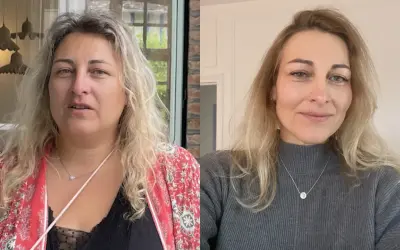 Avant/après : le visage s'affine visiblement après une perte de poids. La question "à partir de combien de kilos perd on du visage" trouve ici une réponse visuelle.
