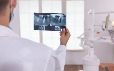 Dentysta analizuje RTG, by sprawdzić, ile kanałów ma ząb 7 dolny. Widać implant.