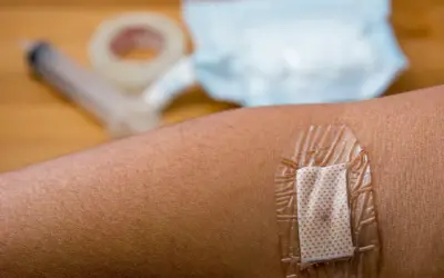 Plaster na skórze, pod nim widoczna drobna ziarnina. W tle strzykawka i taśma medyczna.