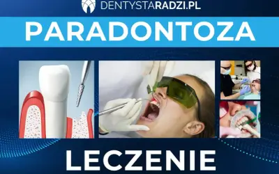 Grafika przedstawia leczenie paradontozy: ilustrację zęba z ubytkami kostnymi, zabieg laserowy i stomatologiczne procedury.