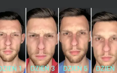 Mężczyzna pokazuje zmiany na twarzy po 7 dniach stosowania Denofix. Widać redukcję zmarszczek na czole i wokół oczu.