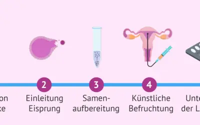 Der Insemination Ablauf: Stimulation der Eierstöcke, Eisprung-Einleitung, Samenvorbereitung, künstliche Befruchtung, Lutealphase-Unterstützung.