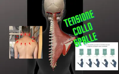 Anatomia muscolare e scheletrica del collo e delle spalle, con frecce rosse che indicano punti di dolore e un grafico sulla tensione muscolare collo.