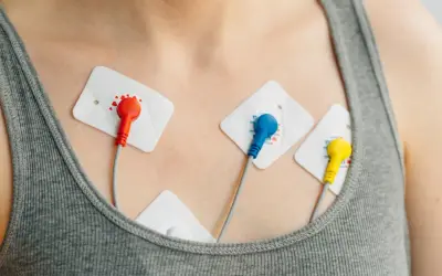Elektrody EKG na klatce piersiowej, monitorujące pracę serca w celu wykrycia arytmii.