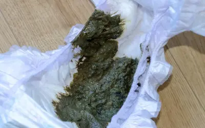 Zielona kupa w pieluszce, która wymaga zmiany.