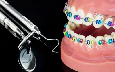 Kolorowy aparat ortodontyczny na modelach szczęk, symbolizujący korektę zgryzu krzyżowego przed i po. Obok narzędzia dentystyczne.