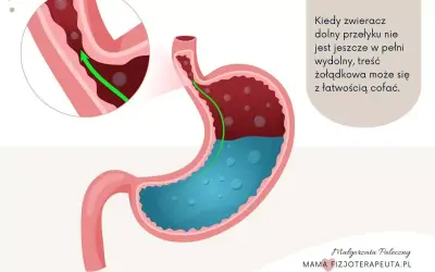 Ilustracja pokazuje cofanie się treści żołądkowej do przełyku, co jest przyczyną refluksu u dzieci. Zielona strzałka wskazuje cofanie się.