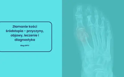 Rentgen stopy ukazujący złamanie kości śródstopia. Tekst informuje o przyczynach, objawach, leczeniu i diagnostyce.