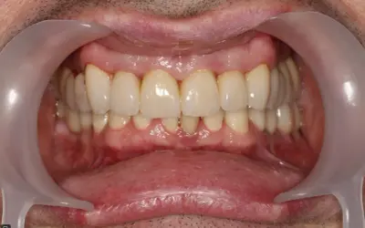 Zdrowe dziąsła i zęby to podstawa. Dowiedz się, czym jest periodontologia i jak dbać o piękny uśmiech.