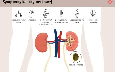 Diagnostyka kamicy nerkowej: Jakie badania i co oznaczają?